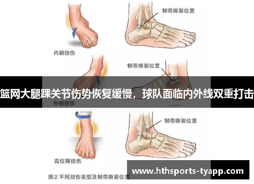 篮网大腿踝关节伤势恢复缓慢，球队面临内外线双重打击